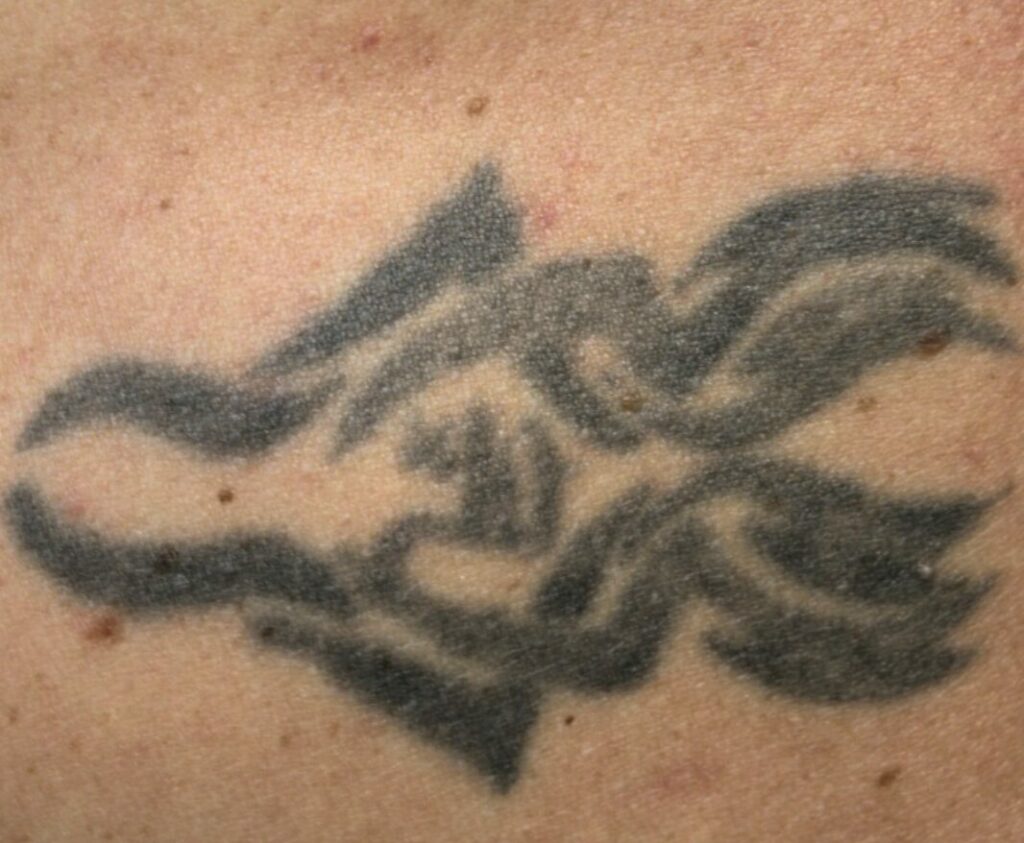 tatouage avant