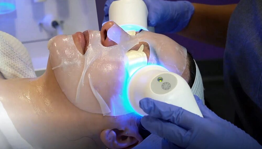 traitement Glacē hydrodermabrasion, LED et cupping pour une peau lisse, hydratée et lumineuse